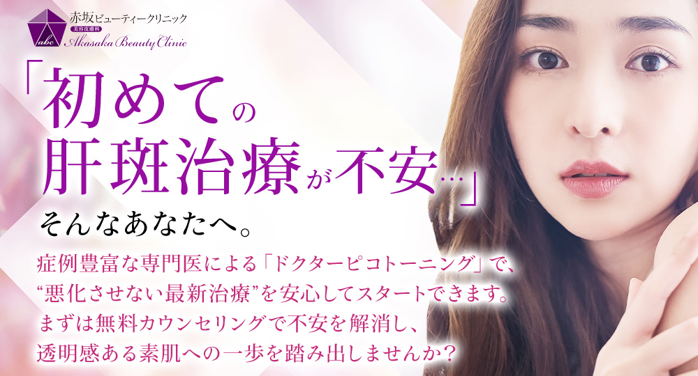 「私のシミって肝斑なの?」とお考えのあなたへ