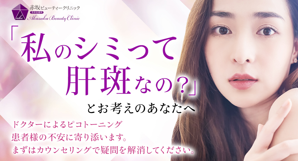 「私のシミって肝斑なの？」とお考えのあなたへ