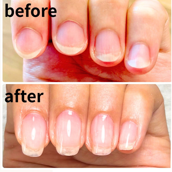 ビフォーアフター