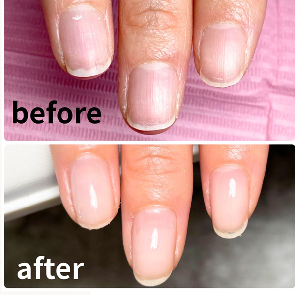 ビフォーアフター