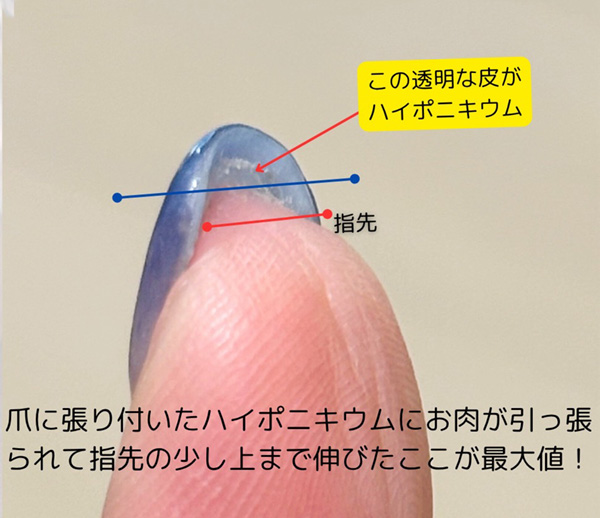 ハイポニキウムの写真