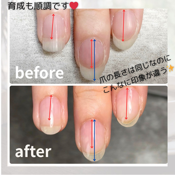 白い部分が長い爪と美爪のビフォーアフター