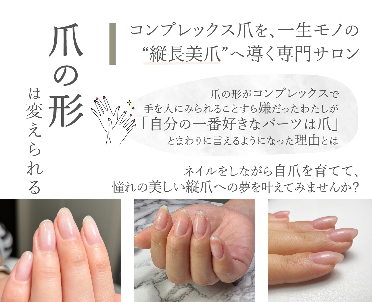 「爪の形は変えられる」 コンプレックス爪を、一生モノの“縦長美爪”へ導く専門サロン