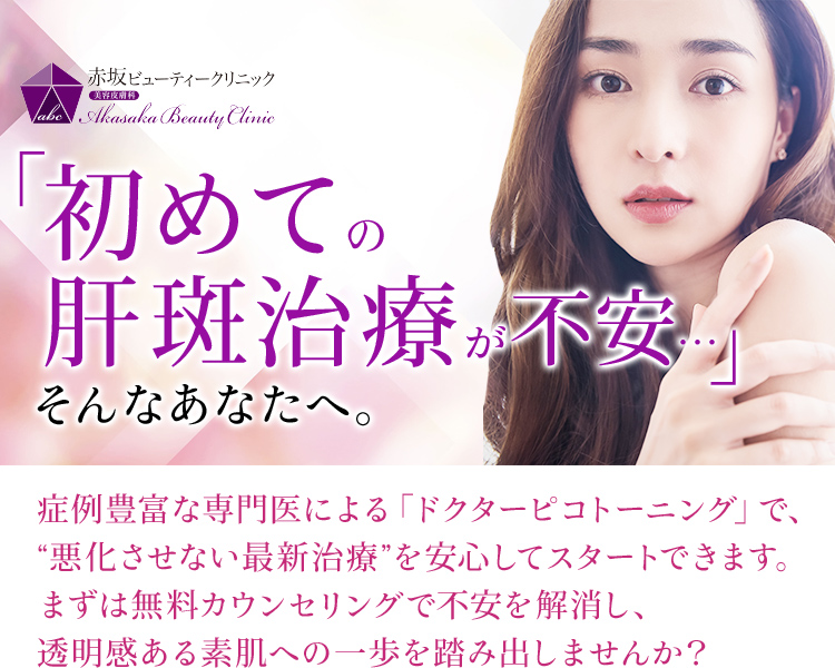 「私のシミって肝斑なの?」とお考えのあなたへ