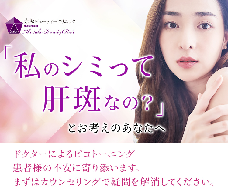 「私のシミって肝斑なの？」とお考えのあなたへ